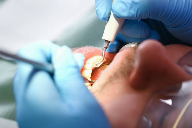 Best Emergency Broken Tooth Repair in Monrovia, IN